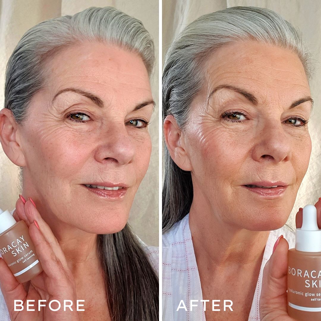 Before and after skin appearance using Boracay Skin Hyaluronic Glow Serum showing subtle tan and smoother skin